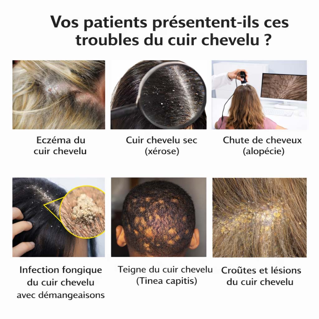 Analyse du cuir chevelu en institut avec le Dermalys HairScan IA